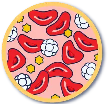 Thalassemia blood cell